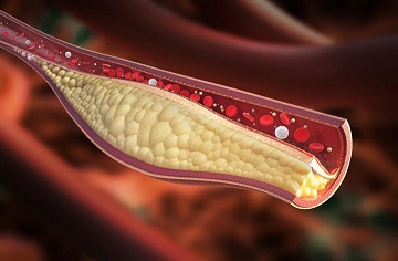 Other information on cholesterol